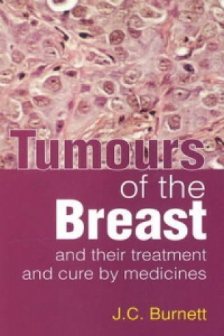 Könyv Tumours of the Breast J.C-. Burnett