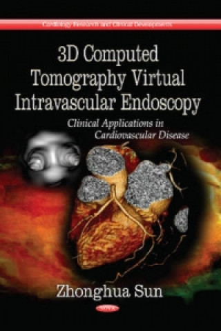 Książka 3D Computed Tomography Virtual Intravascular Endoscopy Zhonghua Sun