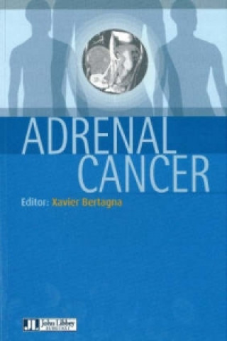 Carte Adrenal Cancer 