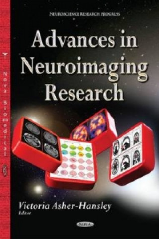 Книга Advances in Neuroimaging Research 