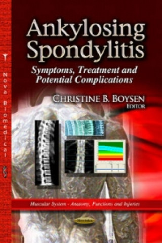Carte Ankylosing Spondylitis 
