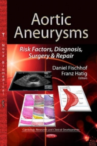 Könyv Aortic Aneurysms 