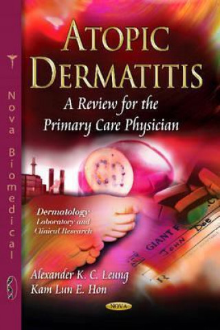 Kniha Atopic Dermatitis 