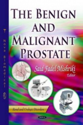 Kniha Benign & Malignant Prostate 