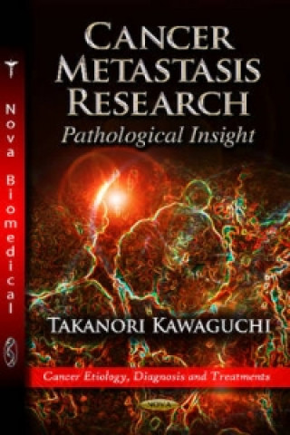 Carte Cancer Metastasis Research Takanori Kawaguchi