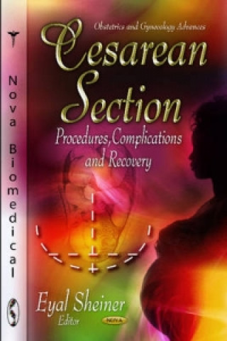 Knjiga Cesarean Section Eyal Sheiner