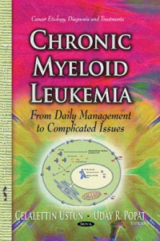Carte Chronic Myeloid Leukemia 