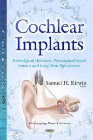 Kniha Cochlear Implants 