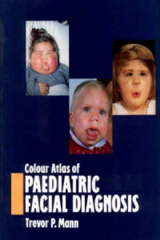 Kniha Colour Atlas of Paediatric Facial Diagnosis Trevor P. Mann