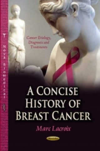 Könyv Concise History of Breast Cancer 