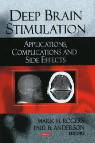 Książka Deep Brain Stimulation Paul B. Anderson