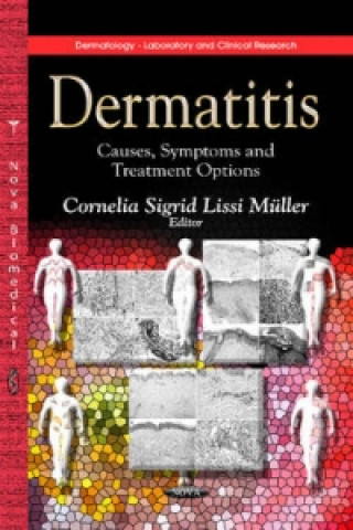 Kniha Dermatitis 