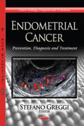 Knjiga Endometrial Cancer 