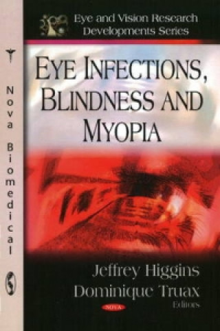 Książka Eye Infections, Blindness & Myopia 