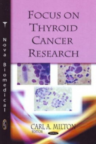 Kniha Focus on Thyroid Cancer Research 