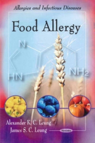 Carte Food Allergy James S. C. Leung