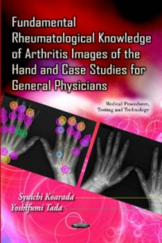 Książka Fundamental Rheumatological Knowledge of Arthritis Images of the Hand & Case Studies for General Physicians 