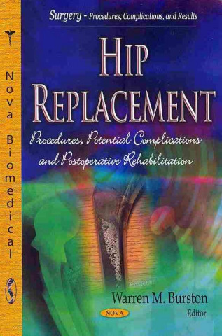 Kniha Hip Replacement Warren M. Burston