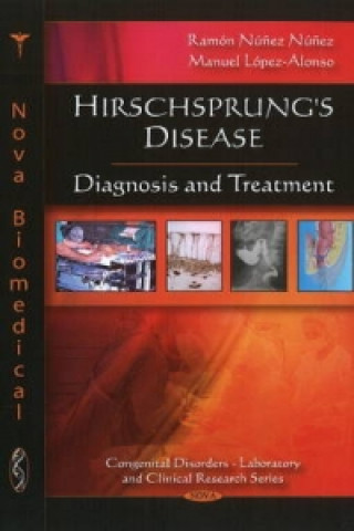 Kniha Hirschsprung's Disease 