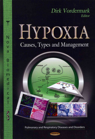 Libro Hypoxia Dirk Vordermark