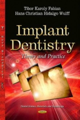 Carte Implant Dentistry Hans Christian Hidalgo Wulff