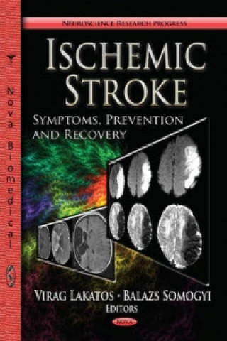 Carte Ischemic Stroke 