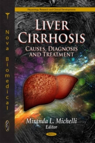 Carte Liver Cirrhosis 