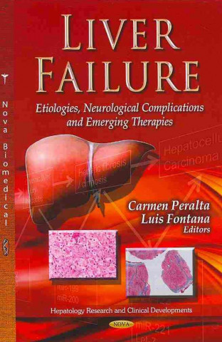 Книга Liver Failure 
