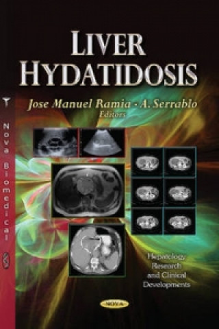 Livre Liver Hydatidosis 