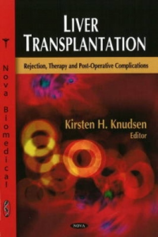 Kniha Liver Transplantation 