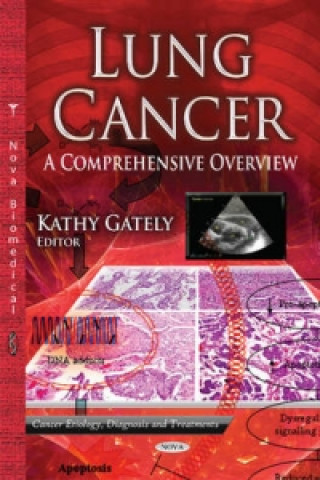 Könyv Lung Cancer 