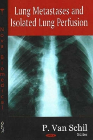 Kniha Lung Metastases & Isolated Lung Perfusion 