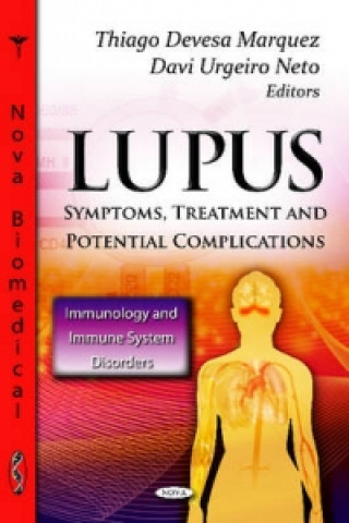 Könyv Lupus 