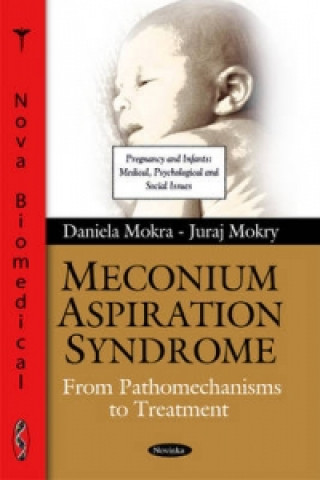 Kniha Meconium Aspiration Syndrome Juraj Mokry