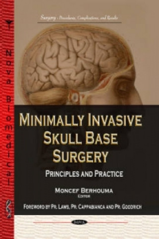 Carte Minimally Invasive Skull Base Surgery 