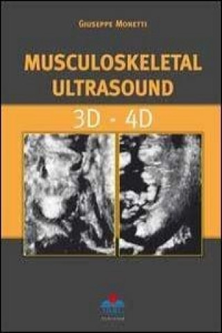 Kniha Musculoskeletal Ultrasound 3D - 4D Giuseppe Monetti