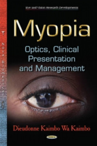 Carte Myopia. Optics. Clinical Presentation and Management Dieudonne Kaimbo Wa Kaimbo