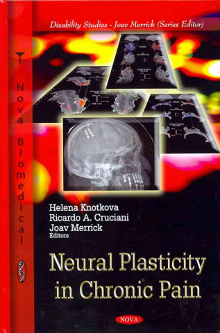 Kniha Neural Plasticity in Chronic Pain 