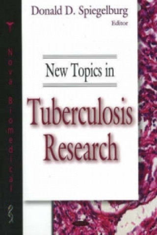 Carte New Topics in Tuberculosis Research 