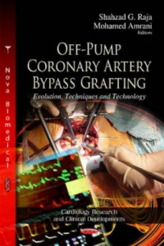 Книга Off-Pump Coronary Artery Bypass Grafting 