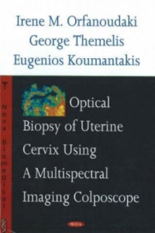 Książka Optical Biopsy of Uterine Cervix Using a Multispectral Imaging Colposcope Eugenios Koumantakis