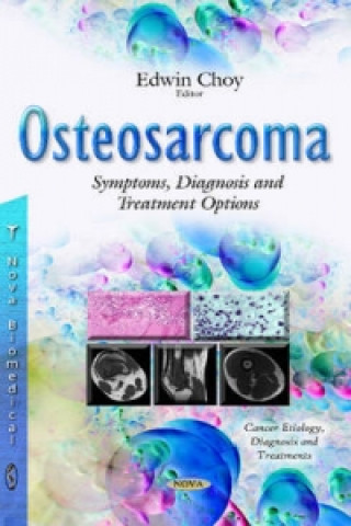 Knjiga Osteosarcoma Dana Farber