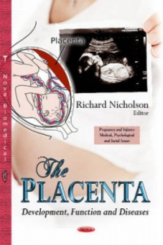 Könyv Placenta 