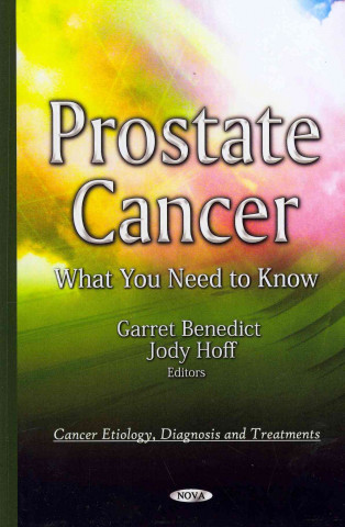 Könyv Prostate Cancer 