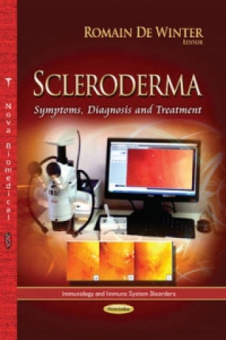 Carte Scleroderma 