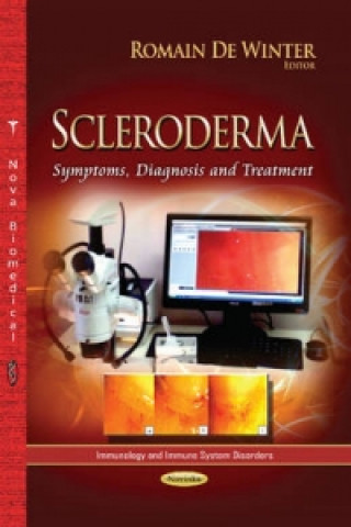 Livre Scleroderma 