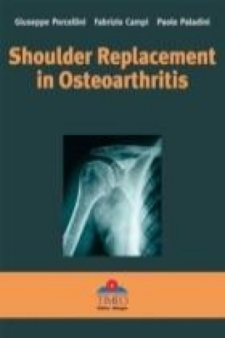 Książka Shoulder Replacement in Osteoarthritis Paolo Paladini