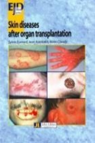 Carte Skin Diseases After Organ Transplantation Alain Claudy