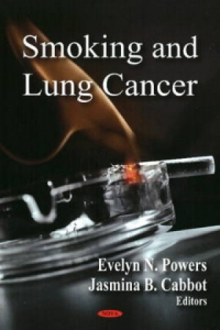 Könyv Smoking & Lung Cancer 