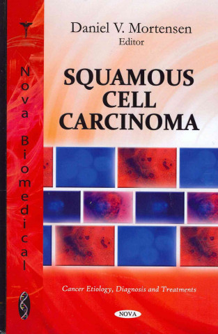Könyv Squamous Cell Carcinoma 